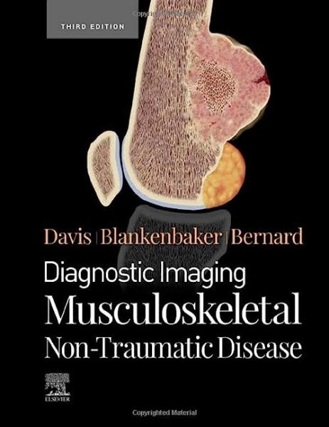 تصویربرداری تشخیصی: بیماری اسکلتی عضلانی غیر تروماتیک - رادیولوژی